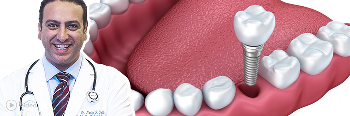 Dr. Nader Salib: 3D Printing in Dental | Video