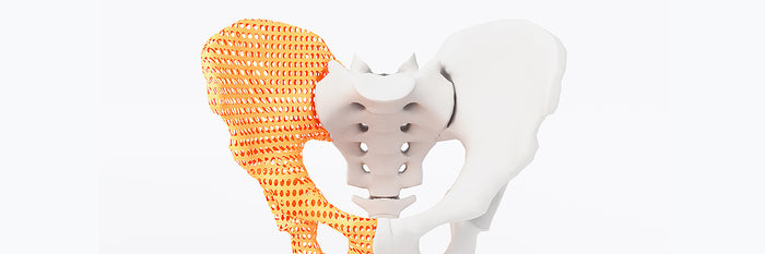 Medical Models: Printing bones for surgical testing