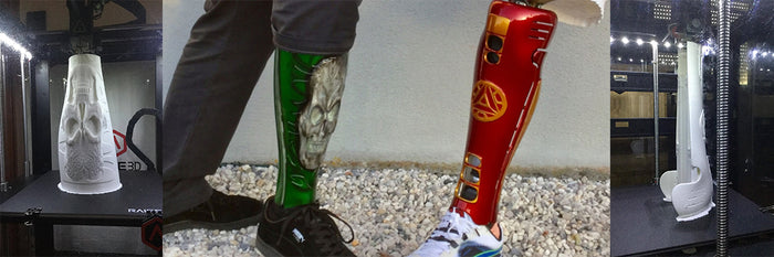 3D Printed Prosthetic Legs